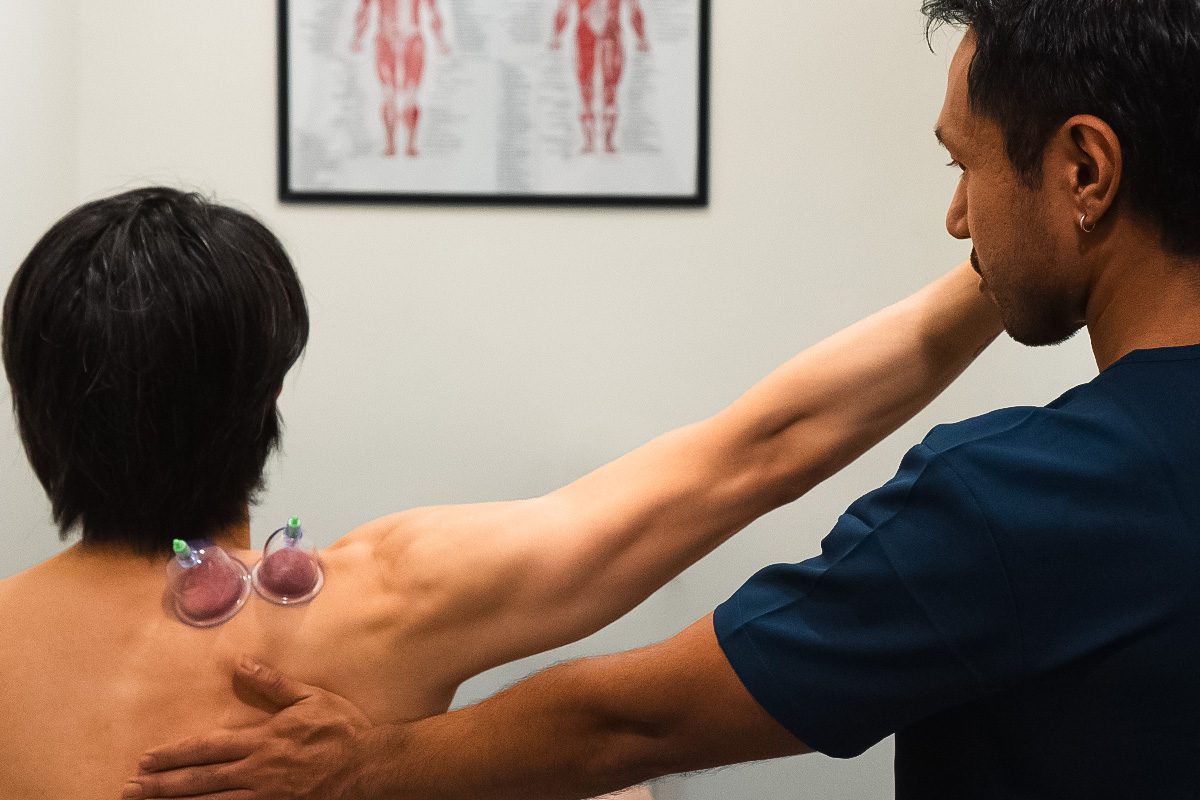 A member of the recovery team guiding a shoulder stretch with cupping in place in the treatment room.